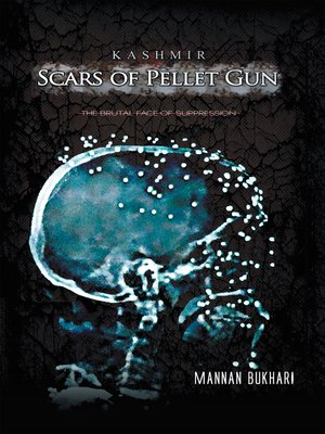 cover image of Kashmir--Scars of Pellet Gun